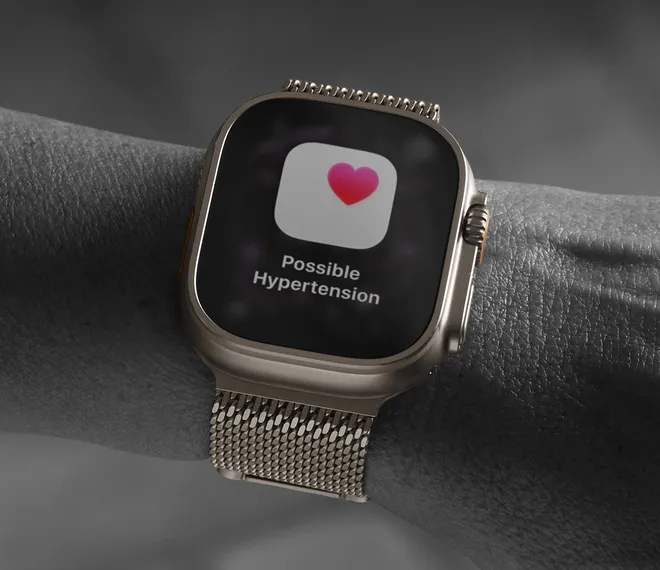 Apple Watch Series 11 vs Series 10: когда эволюция действительно ощущается